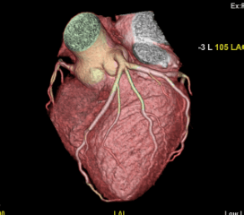 Cardiac 8