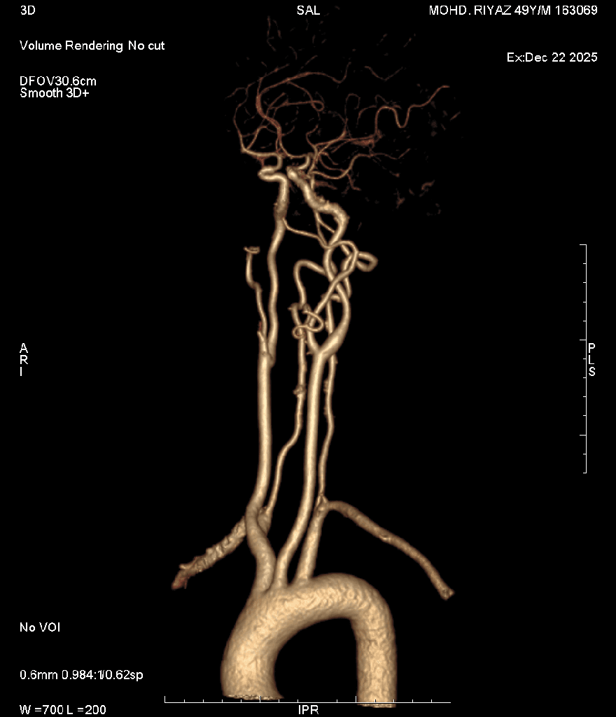 Angiography 1