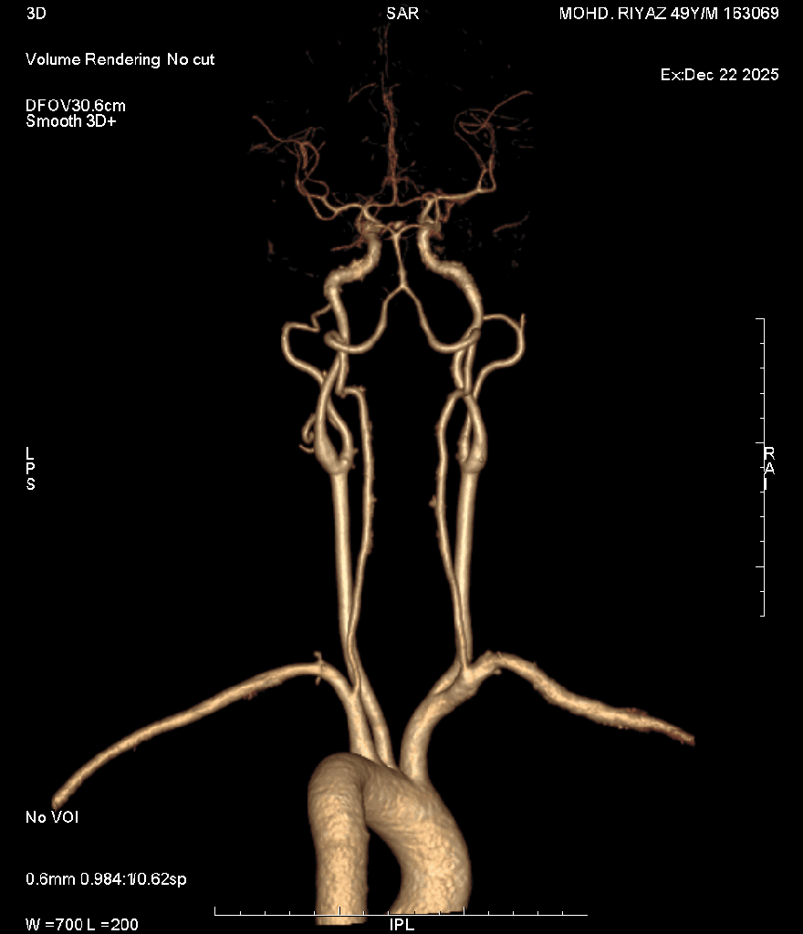 Angiography 2