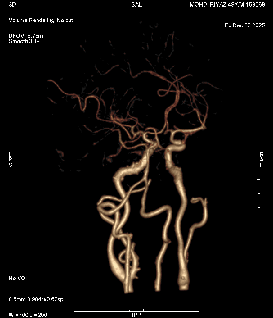 Angiography 7